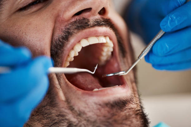 Best Urgent Dental Care for Toothache in Wolfforth, TX