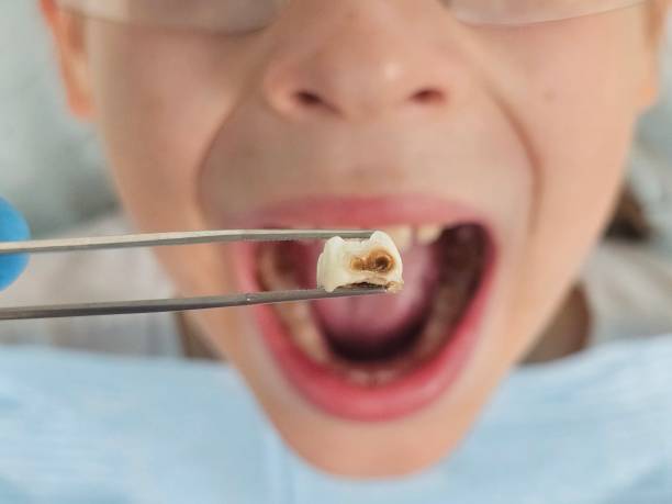Best Urgent Dental Care for Toothache in Wolfforth, TX